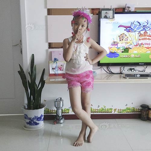 Ảnh chân thực về chiếc bụng nhăn nhúm sau đẻ mổ - 12
