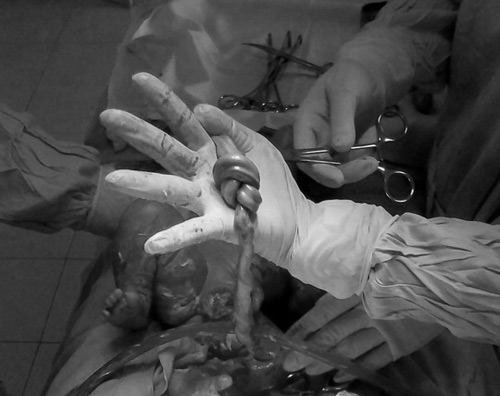 Khám phá những thú vị về dây rốn thai nhi - 3