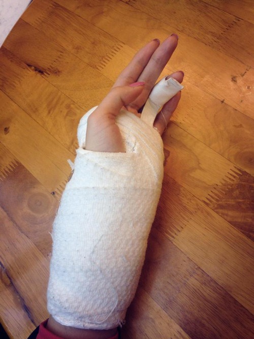 Hoàng Yến lên tiếng việc làm gãy tay mẫu Tây - 5