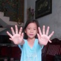 Tin tức - Kỳ lạ cô bé có 24 ngón tay, chân ở Quảng Nam