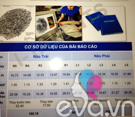 Sinh trắc vân tay: Tốn 3 triệu vẫn hút khách - 1