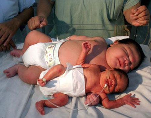 8 bé sơ sinh vừa chào đời đã...to nhất thế giới - 3
