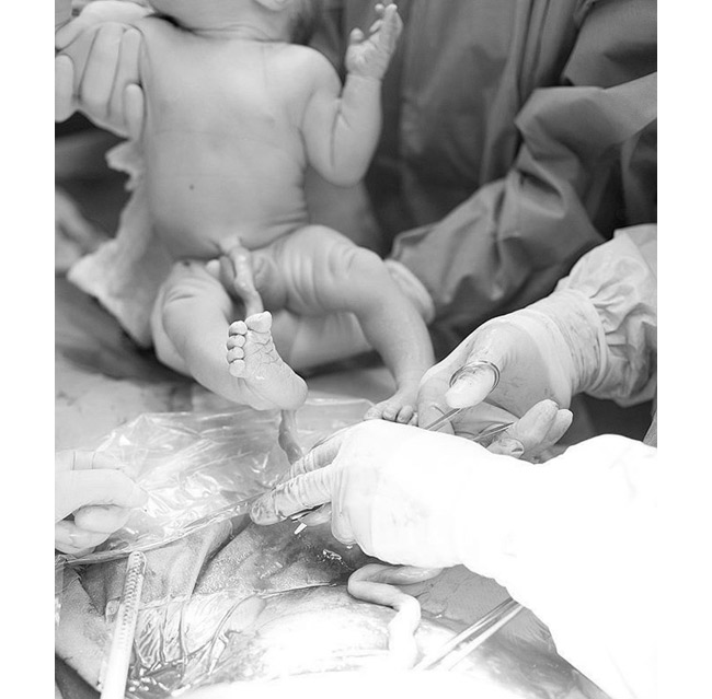 Ngay sau khi chào đời, em bé được các bác sĩ dùng khăn mềm vệ sinh sạch sẽ.
