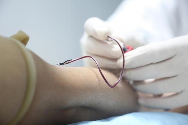 Để hiến tinh trùng, những tình nguyện viên phải trải qua rất nhiều xét nghiệm máu, dịch niệu đạo…để đảm bảo tinh trùng hiến tặng là hợp lệ và an toàn.
