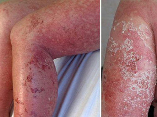 Mốt lột da: Thích trắng ở đâu cũng quot;chiềuquot; - 3