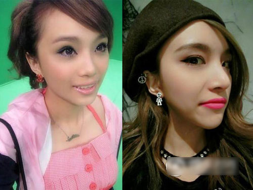 Hậu quả khôn lường vì quot;cuồngquot; phẫu thuật thẩm mỹ - 15