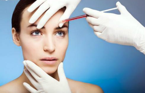 Bủn rủn với mốt trẻ hóa, căng da mặt bằng... máu - 4