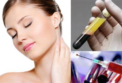 Bủn rủn với mốt trẻ hóa, căng da mặt bằng... máu - 1