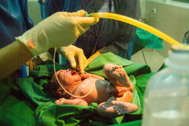 Em bé được bác sĩ sơ sinh và y tá thăm khám, đánh giá thông số sức khỏe và làm vệ sinh.
