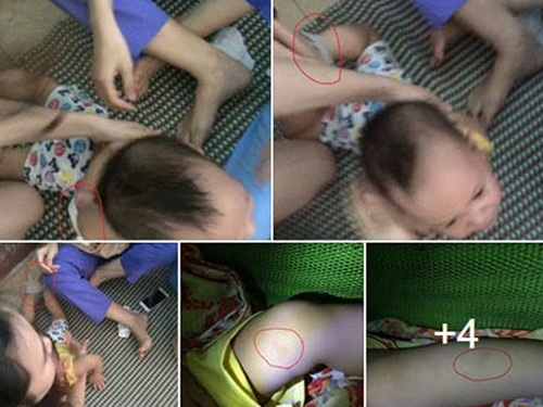 Người thân bé 15 tháng chưa tha thứ cho bảo mẫu bạo hành - 2