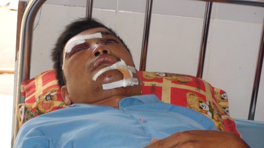 Ghen tuông, kéo người chém bạn trai của vợ cũ - 1