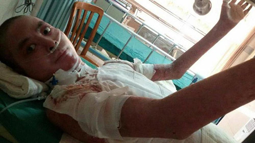 Cảm động: Hai bé tiểu học dũng cảm hiến da đầu cứu cha - 1