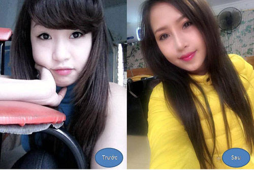 Bật mí cách tự làm mũi cao đẹp “hết ý” - 1