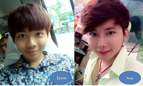 Bật mí cách tự làm mũi cao đẹp “hết ý” - 2