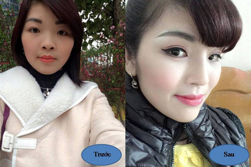 Bật mí cách tự làm mũi cao đẹp “hết ý” - 5