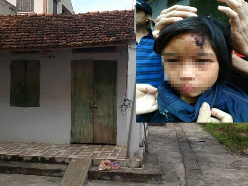 Giải cứu bé gái bị nhốt trên người chằng chịt vết thương - 1
