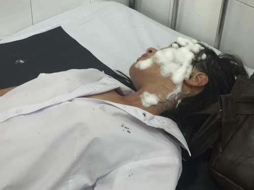 Hung thủ tạt axit 2 nữ sinh khai gì tại cơ quan điều tra? - 1