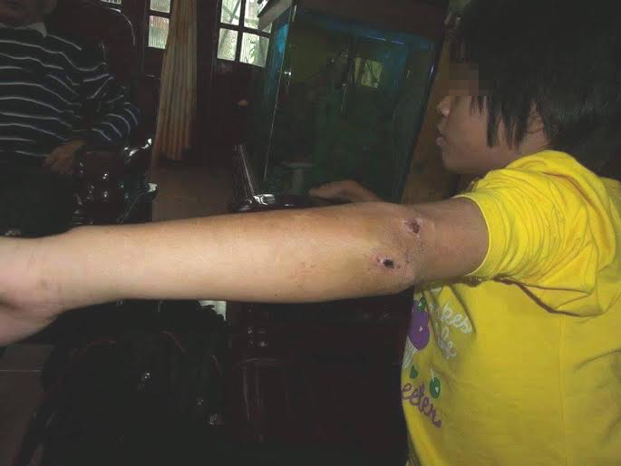 CA Hưng Yên thông tin vụ bé gái thương tích bị nhốt trong chùa - 3