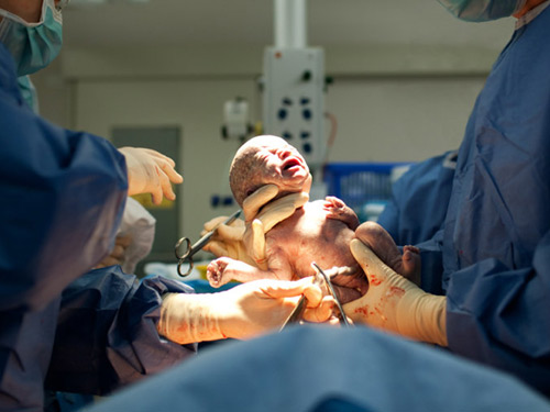 Những nguy hiểm quot;rình rậpquot; mẹ sau sinh mổ - 2