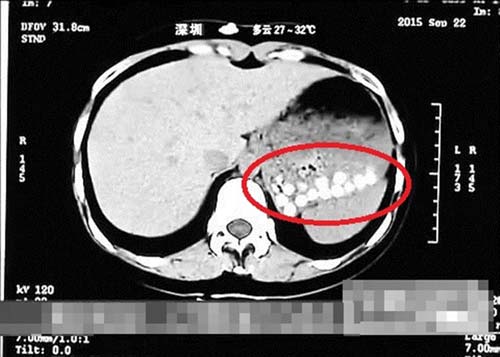 Hãi hùng trà sữa trân châu TQ làm từ da giày, lốp xe cũ - 1
