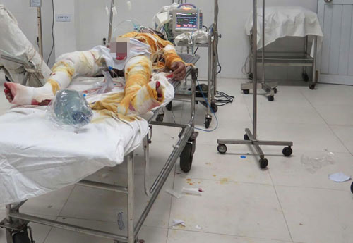 Chồng mua xăng tưới lên người rồi ôm vợ tự thiêu - 1