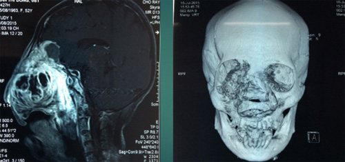 Chuyện người đàn bà ‘mọc thêm đầu’ trên mặt - 1