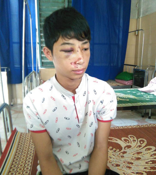 CA xã đánh học sinh lớp 10 nhập viện vì nhầm là trộm - 1