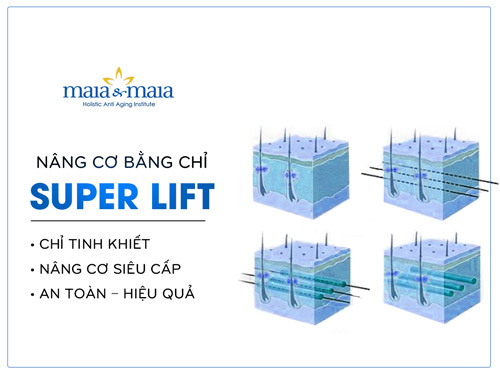 Bước đột phá ngoạn mục của công nghệ nâng cơ - 2