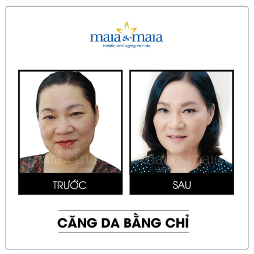 Bước đột phá ngoạn mục của công nghệ nâng cơ - 3