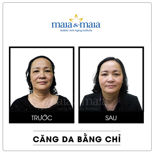 Bước đột phá ngoạn mục của công nghệ nâng cơ - 4