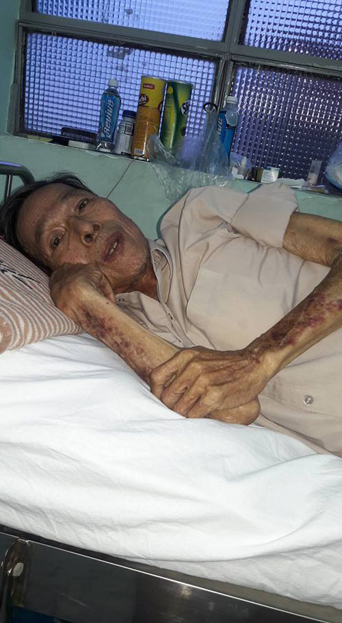 Tuổi già bệnh tật của diễn viên phim quot;Ván bài lật ngửaquot; - 1