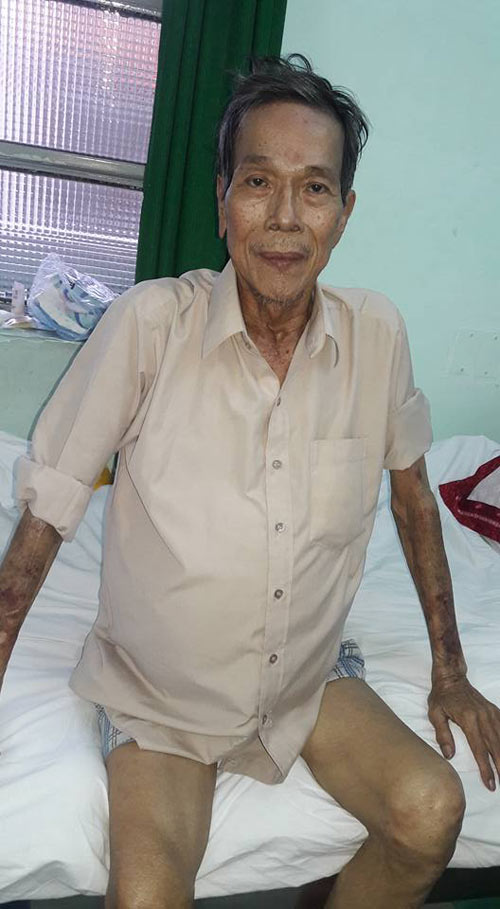 Tuổi già bệnh tật của diễn viên phim quot;Ván bài lật ngửaquot; - 2