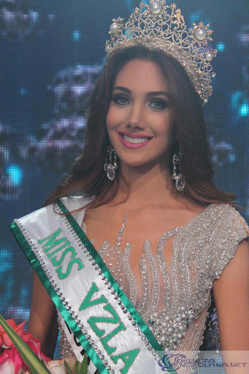 Tân Hoa hậu quốc tế 2015 bị rò rỉ ảnh phẫu thuật thẩm mỹ - 12