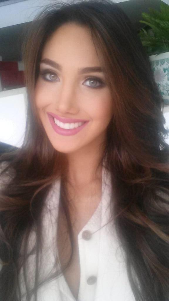 Tân Hoa hậu quốc tế 2015 bị rò rỉ ảnh phẫu thuật thẩm mỹ - 8