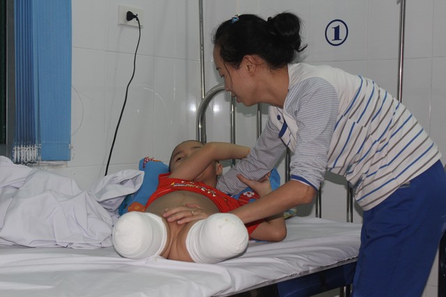 Mẹ ơi, chân của con đâu rồi? - 1