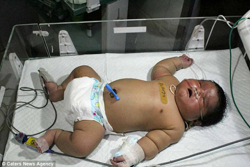 Ấn Độ: Bé sơ sinh nặng 7kg chào đời bằng phương pháp đẻ thường - 1