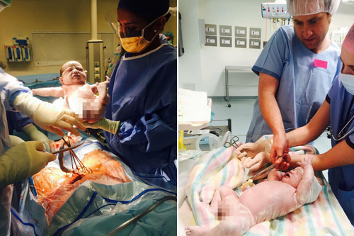 Chuyện sinh mổ ngoài dự kiến của mẹ Việt ở Úc - 1