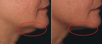 Diễm My 9x và bí quyết làm đẹp “thức thời” - 7