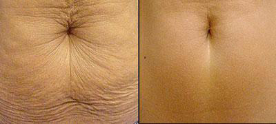 Diễm My 9x và bí quyết làm đẹp “thức thời” - 8