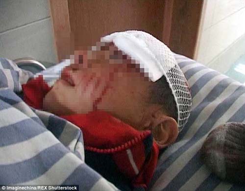 Tai nạn thang cuốn ở Trung Quốc, 16 học sinh nhập viện - 1