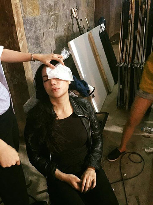 Trương Ngọc Ánh bị bầm tím mắt khi đang quay phim - 2