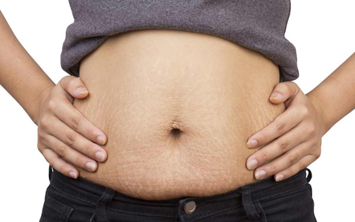 Đừng “khóc” với sự thay đổi của cơ thể sau sinh - 1