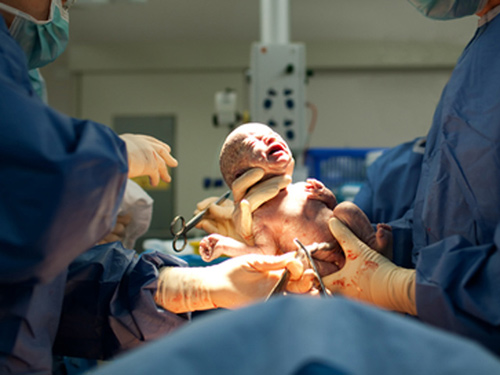 Lời khuyên #039;vàng#039; mẹ nào cũng cần biết trước khi đẻ mổ - 1