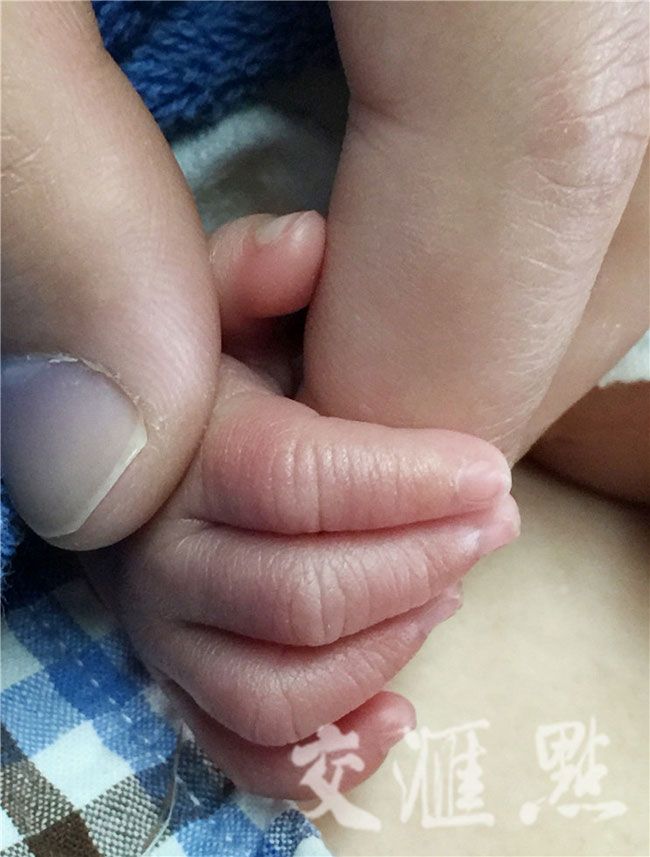 Ảnh hai ông bố ấp con sinh non gây xúc động dân mạng - 9