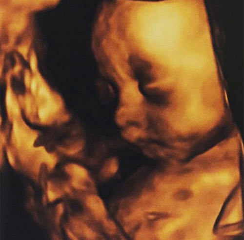 Mang thai 8 tháng, mẹ bầu Thái Lan vẫn đẹp quot;khó cưỡngquot; - 18