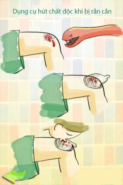 Giật mình với công dụng bất ngờ của bao cao su - 1