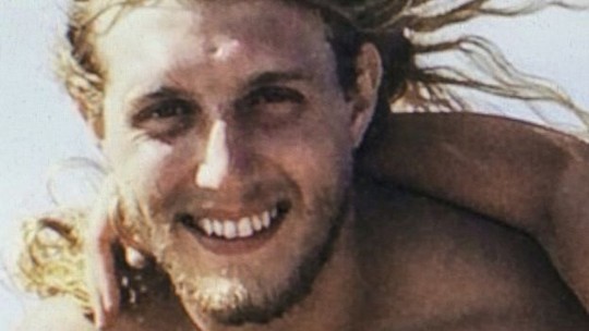 Ca ghép mặt lớn nhất thế giới cho lính cứu hỏa Mỹ - 3