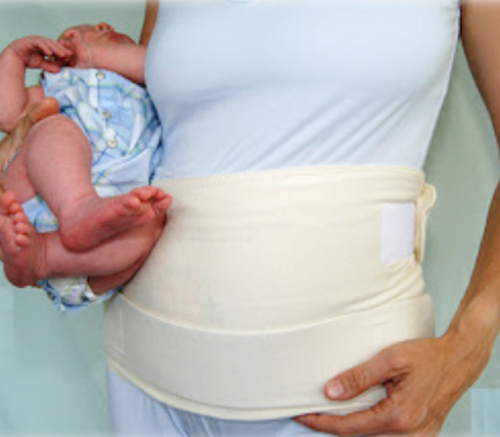 Chăm sóc vết mổ đẻ đúng cách sau sinh - 2