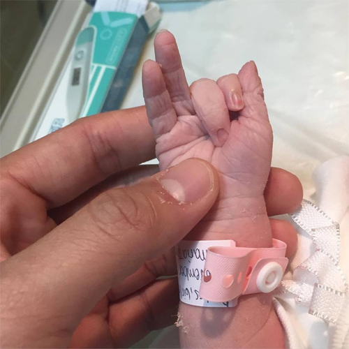 Dingdong Dantes khoe ảnh đầu tiên của con gái - 1