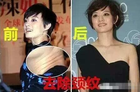 quot;Mị Nguyệtquot; Tôn Lệ thừa nhận mình từng quot;dao kéoquot; - 2
